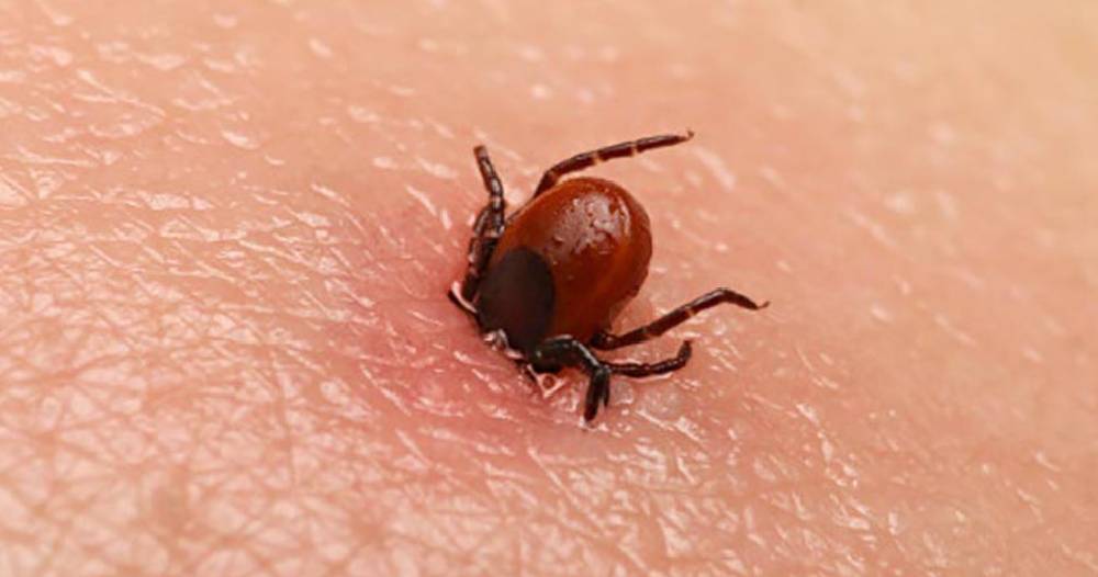 चितवनमा स्क्रब टाइफस संक्रमण बढ्दो, एक वर्षमा एक हजार ५५ संक्रमित